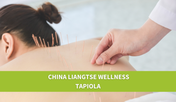 China Liangtse Wellness – 50 min akupunktio ja hieronta | Säästä 40 % | Espoo, Tapiola